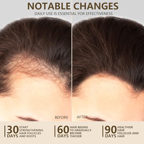 100% Natural Raw Batana Oil for Hair Growth, Unrefined & Organic Dr Sebi Hair Growth Oil From Honduras, Prevents Hair Loss, Eliminates Split Ends, Enhances Thickness 4.23 Fl Oz (Pack of 1)