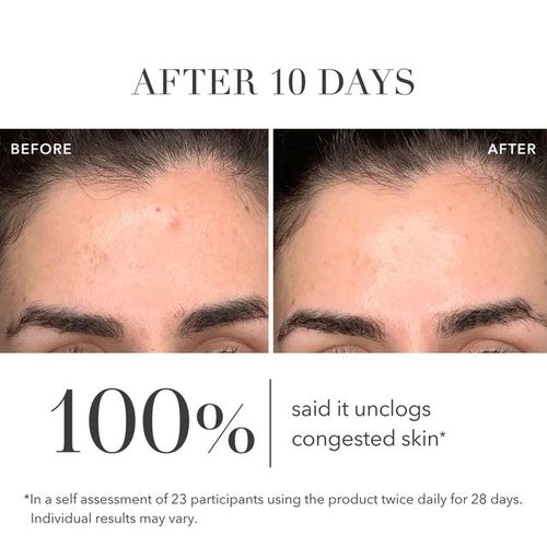 Algenist Genius Liquid Skin Resurfacing 2% BHA Toner - Facial Exfoliator for Fine Lines and Wrinkles - Collagen for Skin & Pore Refining Toner (3.4 oz)