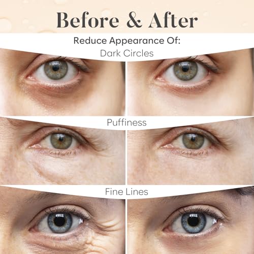 AURAE Caffeine Under Eye Patches (30 Pairs) - For Dark Circles & Puffiness - Hydrating Caffeine Eye Mask