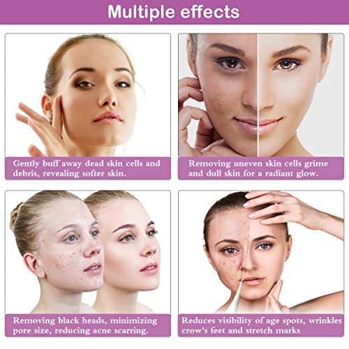 Diamond Microdermabrasion Machine, Yofuly 65-68cmHg Suction Power Professional Dermabrasion, Home Use Facial Skin Care Equipment