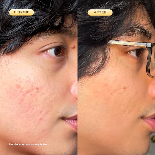 KraveBeauty 24 Carrot Retinal - 30ml, Gentle Retinal Serum, Smooths Skin Texture, Supports Skin Barrier, Lightweight Non-Sticky Gel, Nourishes with Upcycled Carrot Extract