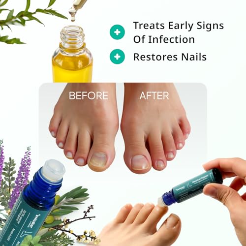 Swissklip KlearNail Toenail Stick | Medi-Care Treatment | Natural Solution for Healthy Nails I Suitable For Foot, Toe, and Fingernail I For Brittle Toenails ? 10ml / 0.3 Fl. Oz. Pack 1 - Made in USA