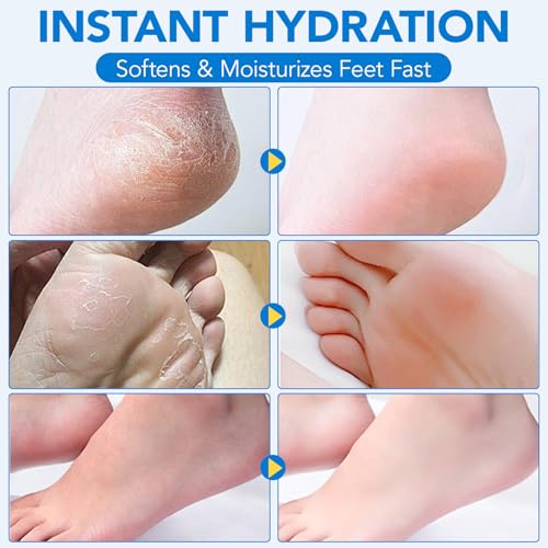 2Pack Urea Cream 60% plus Salicylic Acid 2% Urea Foot Care Stick,Foot Cream for Foot Callus Remover, Feet Moisturizer Stick for Dry Cracked Heels, Hands, Knees,Hydrating Heel Balm, Easy To Use