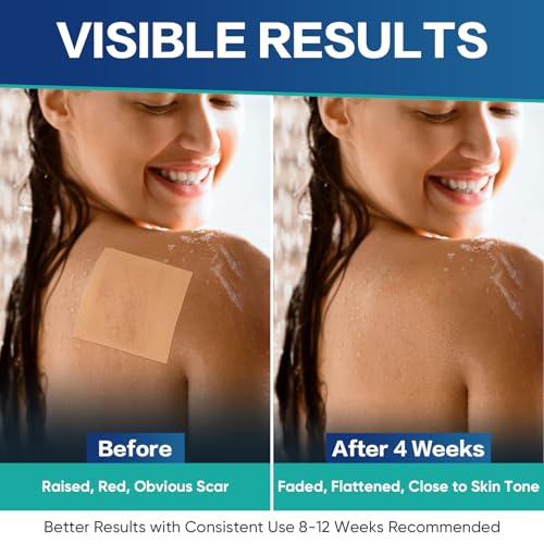Medical Grade Silicone Scar Sheets, 20 Count (10x4 x4+10x1.2 x6) Dual-Size Scar Treatment for Surgical, Burn, Hypertrophic & Keloid Scars, Breathable & Discreet Strips