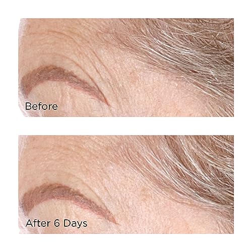 Perricone MD Cold Plasma Plus+ Sheet Mask | Reduces dullness, uneven texture & tone, discoloration & loss of firmness