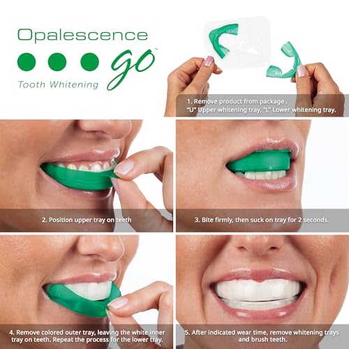 Opalescence Go 10% - Prefilled Teeth Whitening Trays Kit (10 Treatments) - 10% Hydrogen Peroxide - Mint Made by Ultradent Products. Go Teeth Whitening Kit -Mint- GO10-5193-1