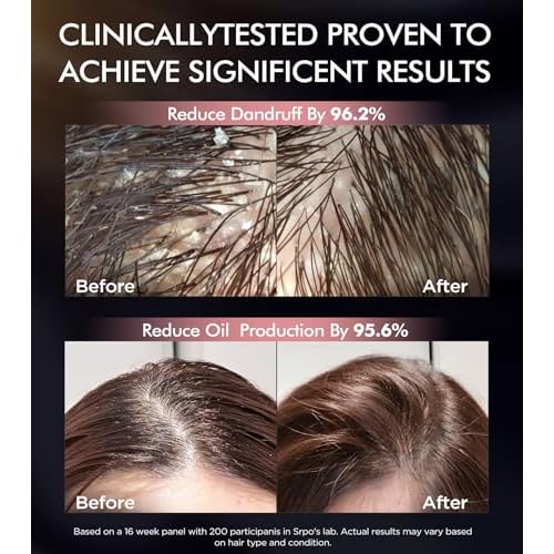 Dual Essence Hair Growth Shampoo and Conditioner Set with Biotin&Tripeptide, 3X Moisturizing Biotin Shampoo for Softer Shiner Hair, Anti-Loss Dandruff Routine Rosemary Shampoo for Men Women, 2x16.9oz