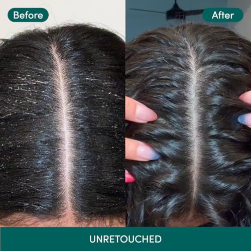 Coco and Eve Clarifying Detox Shampoo. Remove Hard Water & Product Build Up. With Hibiscus Cider Vinegar to Detox Scalp. Color Safe & Non-Stripping. (280 ml)