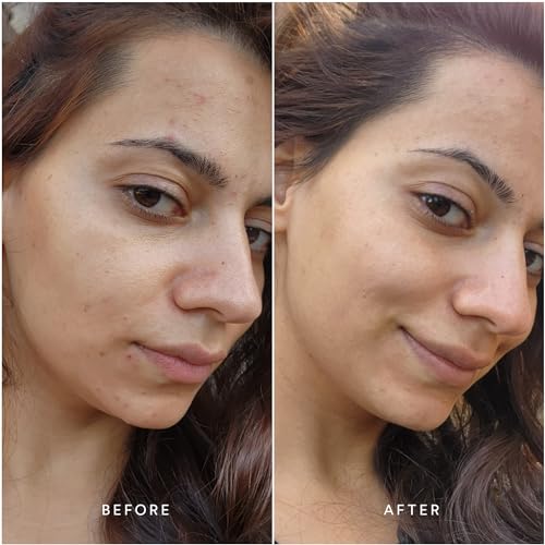True Botanicals Anti-Aging Essentials | Increase Hydration, Treat Fine Lines & Wrinkles | Contains Chebula Active Serum, Renew Pure Radiance Oil, and Phyto Retinol Advanced Clinical Cream