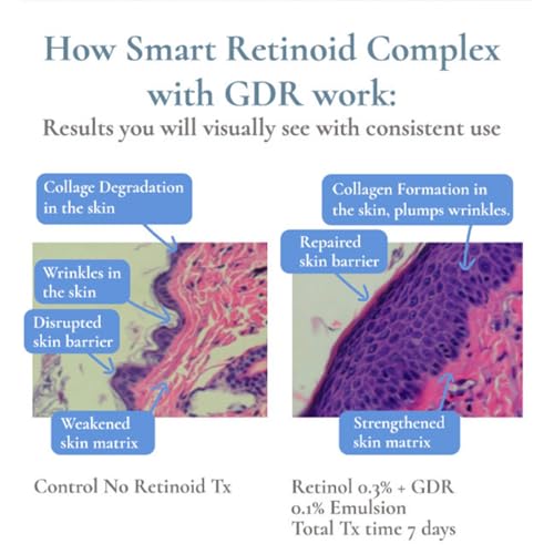 Glowbiotics Ultimate Youth Restoring Serum with Retinol, Probiotics, Vitamin C & Peptides ? 5?in?1 Firming, Brightening Anti?Aging Treatment for Face