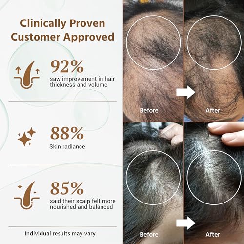 Exosomes for Hair Growth Serum | Clinically Tested Scalp Serum for Hair Thickening, Strengthening, Soothing, Moisturizing & Encouraging Healthier Hair | 1 Set (8ml + 150mg)