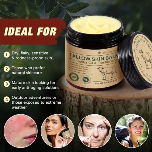 2 Pcak Beef Tallow Cream with Castor Oil and Frankincense, 100% Grass-Fed Tallow for Skin Care, Face & Body Moisturizer for Skin, Sensitive Skin & Dry Skin Age Defying, Eczema All-Purpose Balm