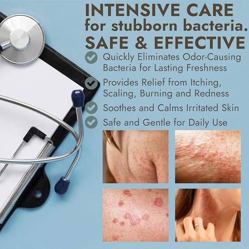 Antibacterial Body Lotion Antifungal Cream | Kills 99.9% of Germs and Bacteria | Helps Sanitize Skin | Infused with Botanical Extracts | Leaves Skin Fresh, Soft & Moisturized | Body Lotion 4 fl oz
