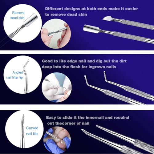 Ingrown Toenail File and Lifters Set(10pcs), Professional Pedicure Tool Toenail Grooming Kit, Ingrown Toenail Treatment Pedicure Kit, Under Nail Cleaner Tools (10PCS)