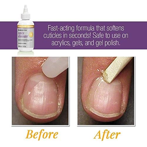 ProLinc Cuticle Eliminator, Softens and Removes Cuticles in Seconds, 4 oz