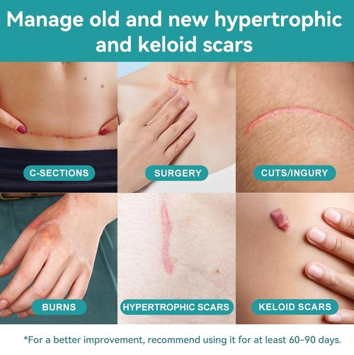 Dimora Hydrocolloid Wound Dressing & Silicone Scar Sheets