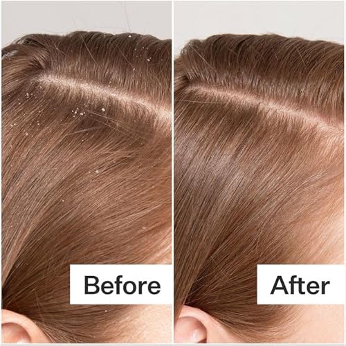 Scalp Serum for Thinning Hair