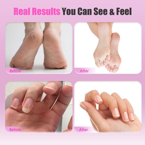 Electric Callus Remover for Feet – 2-in-1 Rechargeable Foot Sander with Sandpaper Discs & Nail Drill Bits, Adjustable Speed, LED Display, Professional Pedicure Tool for Home & Travel
