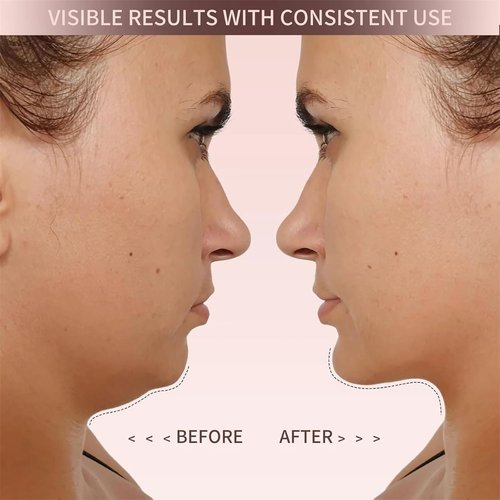 Eleve Beauty Face Shaper, Eleve Beauty V-Line Sculpting Face Mask, Chin Strap For Sleeping, Reusable Face Lift Chin Strap – Silicone Double Chin Reducer (1*Classic Lift)