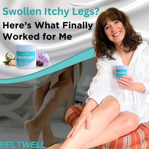 Beltwell® Fragrance-Free Anti-Itch Lotion for Swollen Legs, Dry & Sensitive Skin Relief – Non-Greasy Moisturizer for Itchy Skin, Lymphedema, Diabetes, Eczema, Cracked Feet & Arms – 200ml