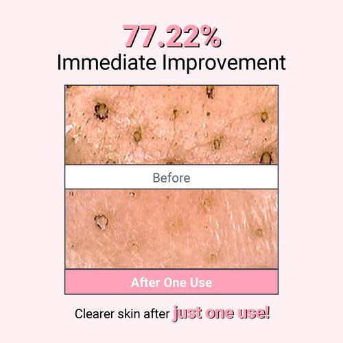 NEAF NEAF Kaolin Purifying Wash Off Pack, Pore Cleansing Mask for Dry Sensitive Skin, Softening and Hydrating, Korean Skincare (3.88oz / 110g)