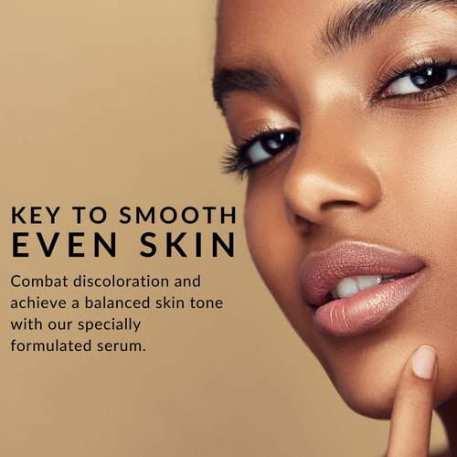 Perfect Tone Moisture Serum by Flori Roberts, Reduces Appearance of Dark Spots, Hyperpigmentation, Lines and Wrinkles, Boosts Radiance