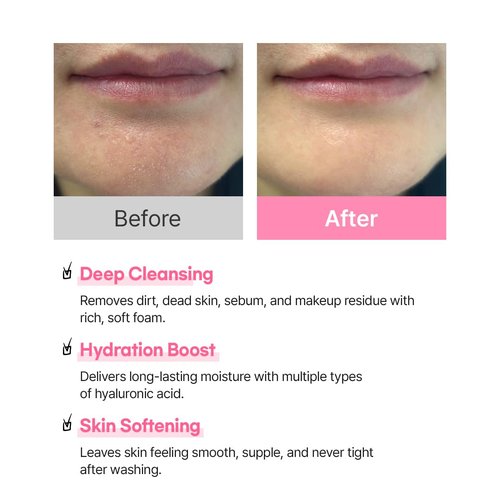 Hanskin Hyaluron Bubble Pop Cleanser – Korean Hydrating Foaming Face Wash with Hyaluronic Acid for Gentle Deep Cleansing, Softening Glow, pH-Balanced Daily Cleanser for Glass Skin | 5.07 fl oz