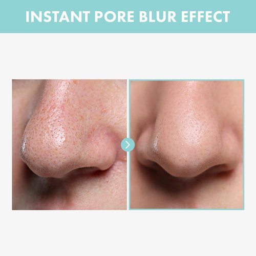 TOSOWOONG Pore Tightening Serum, Instantly Reduces Pores, Smooths Skin & Strengthens Barrier, Formulated With Niacinamide & Allantoin, Pore Minimizer For Face, Korean Skin Care, 30ml, 1.01 fl. oz.