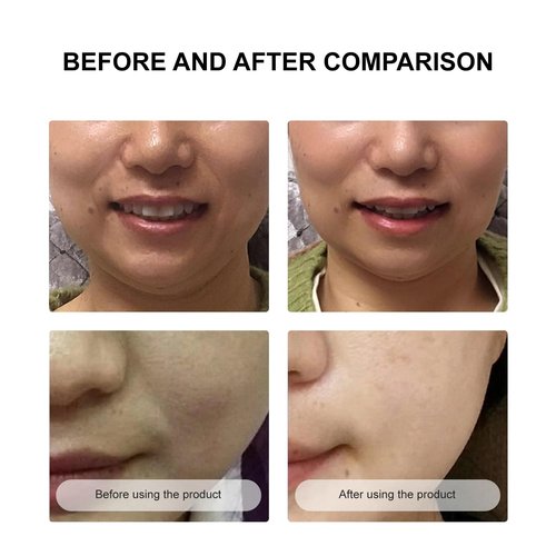 SECRET STRIPS Sheet Face Masks Skincare to Remover Smile Lines, Laugh Lines Anti Wrinkle Patches,Face Lift Beauty & Facial Skin Care Products