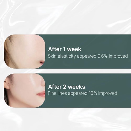 shaishaishai LIPOSOME REPAIR MILKY Cream, 72HR Intensive Hydration, Skin Barrier Repair with Urea 6%, Face Moisturizer, Collagen Boost, Korean Skincare, 1.69 fl oz
