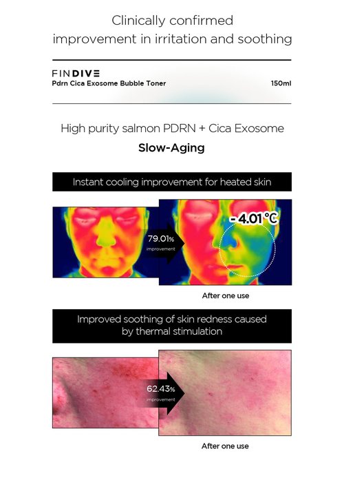 FINDIVE Official PDRN CICA Exosome Bubble Toner, PDRN (Sodium DNA) 1,000ppm, CICA Exosome 1,000ppm, Marin Collagen, Soothes, Regenerates Skin, Korean Skincare 5.07fl.oz