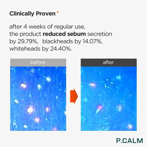P.CALM Barrier Cycle Toner – Azulene & Centella Asiatica for Deep Hydration & Skin Barrier Strengthening, Korean Vegan Facial Toner for Sensitive Skin (500ml / 16.9 fl.oz)