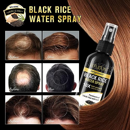 (3Pc) Organic Black Rice Water Spray for Hair Growth, A Solution with Castor Oil & Ginger Root Extract for Thicker, Fuller Hair, Targets Hair Loss and Repairs Damage 300ml/9.6 fl.oz