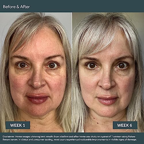 No7 Future Renew Damage Reversal Face Serum - Anti-Aging Serum for Glowing Skin - Hyaluronic Acid + Niacinamide for Sun Damage Reversal - Dermatologist-Approved, Sensitive Skin Suitable (0.33 Fl Oz)