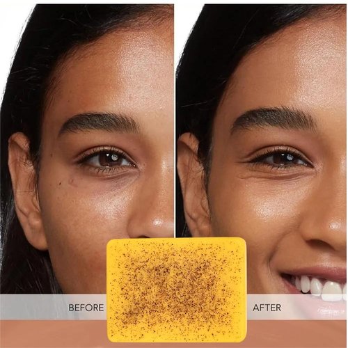 Uselective Lemon & Turmeric Glow Soap Bar - Brightening Bar for Dark Spots & Acne Scars, with Kojic Acid, Vitamin C, Retinol, Shea Butter -30% Larger & SLS Free, for Oily & Dry Skin - 3 Pcs