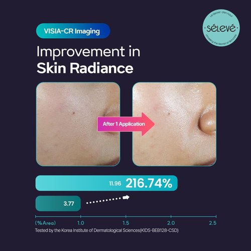 SELEVE Glow Caviar Bubble Toner – Hydrating & Glow Face Toner with Green Caviar Liposomal PDRN, Niacinamide, Panthenol & Ferulic Acid – for Sensitive & Dry Skin, Korean Skin Care (3.38 fl.oz / 100ml)