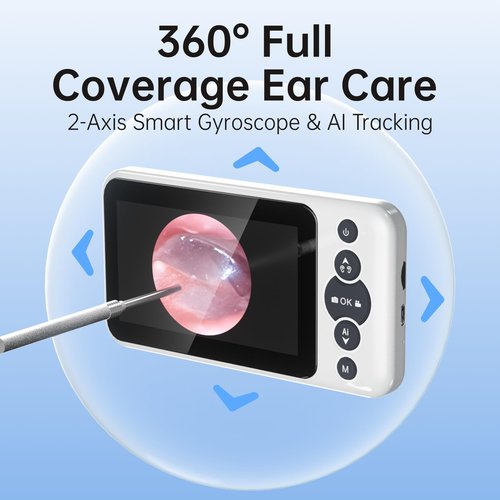 Goingmeta Ear Wax Removal Tool with Camera, Digital Otoscope with Gyroscope - 4.5 Inch HD Screen, 3.9mm Ultra-Thin Probe, 6 LED Light, Video/Photo Capture, 3000mAh Battery & 4GB SD Card