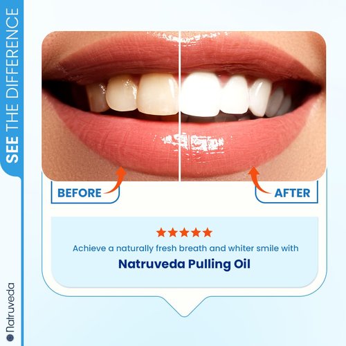 Natruveda Coconut Oil Pulling Mouthwash – 3 Pack, 8 oz Each, Cocomint Flavor, Organic Ayurvedic Oral Rinse, Natural Mouthwash for Teeth and Gums, Coconut Pulling Oil for Daily Oil Pulling