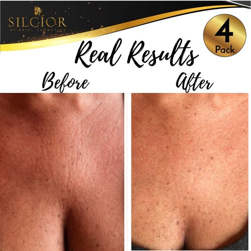 SILCIOR 4 PACK Chest Wrinkle Pads, Silicone Chest Pad, Decollete Anti Wrinkle, Chest Wrinkle Pads Sleeping Reusable, Chest Patches