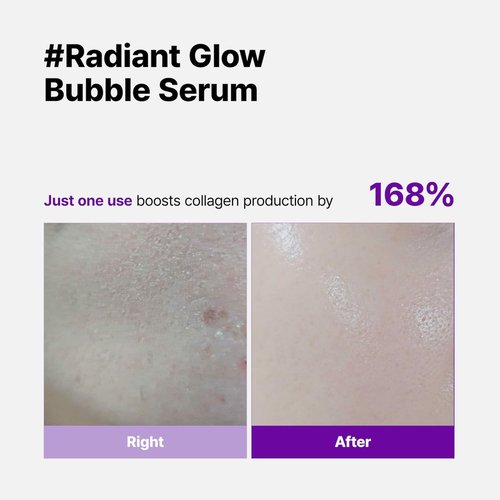 SKINEGO Super Glow Deep Collagen Bubble Serum with 1,005,189ppb Collagen – Anti-Aging, Hydrating, Skin-Firming, Fine Line Care, Korean Skincare – 2.36 fl.oz