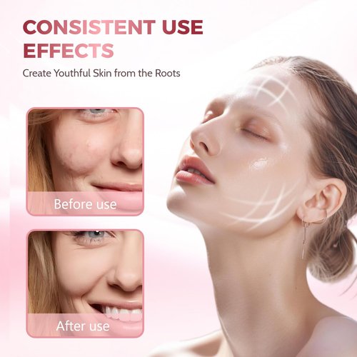 Shquanfuya LED light therapy mask -3Color Light Therapy for Skin Rejuvenation, Wrinkle Reduction & Anti-Aging - Home Beauty Device for Ultimate Facial Care