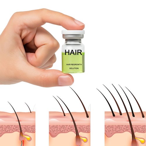 Hair Regrowth System, Advanced Hair Growth Treatment Ginseng, Eclipta Prostrata, Peppermint Oil and Ginger Root, Treatment for Thicker, Strengthens Roots,for Men and Women 1pcs