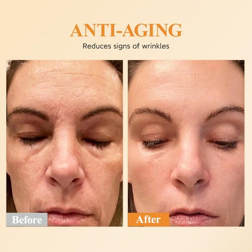 Vitamin C Anti-Wrinkle Aging Face Serum 30 Capsules+Retinol Collagen Anti-Aging Wrinkle 30 Capsules,VC For Morning+VA For Evening,Smooth,Hydrate,Firming Skin,Travel Portable