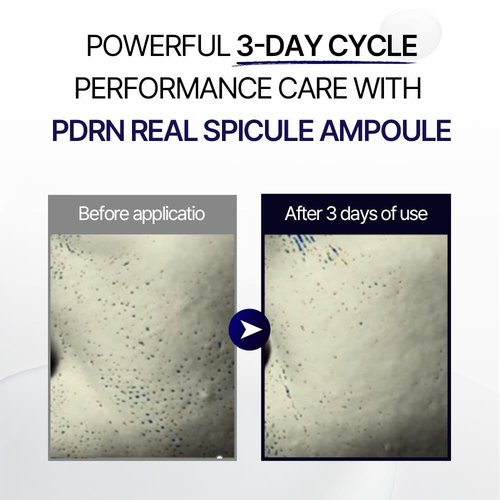 Ultimate Rejuvenation Spicule Serum – Korean Skincare PDRN Serum for Anti-Wrinkle, Pore Care & Skin Renewal – Dermatologist-Tested, Brightening Ampoule for Radiant, Smooth Skin – 50ml