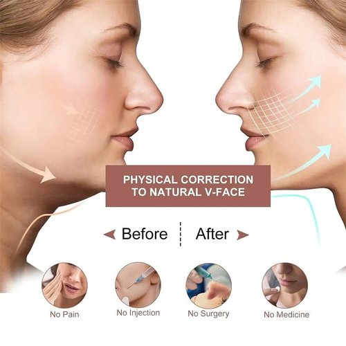 Eleve Beauty Face Shaper, Eleve Beauty V-Line Sculpting Face Mask, Chin Strap For Sleeping, Reusable Face Lift Chin Strap – Silicone Double Chin Reducer (1*Classic Lift)