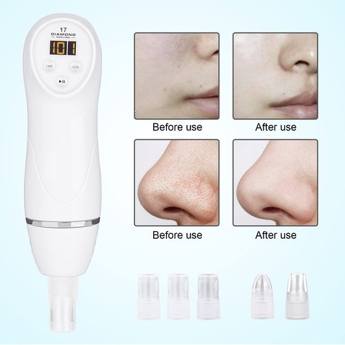 AIMENGXI Diamond Microdermabrasion Machine Professional Blackhead Remover Vacuum Upgraded Facial Pore Cleaner Electric USB with 8 Probes Blackhead Remover Skincare Tool