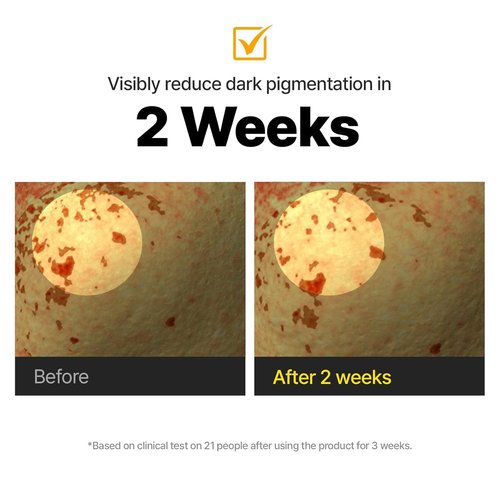 Cell Fusion C Toning C Vita Shot Ampoule, Brightening Vitamin C Serum for Face with Spicules, Zero Dark Spots & Glow Serum for Sensitive Skin, 20g / 0.7 oz.