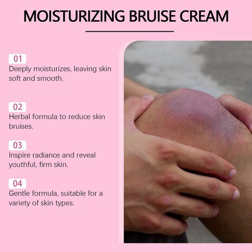 Bruise Cream – Moisturizing & Firming Formula for Arms, Legs & Hands – Restores Fragile Skin with Anti-Wrinkle Benefits – 4.23 oz