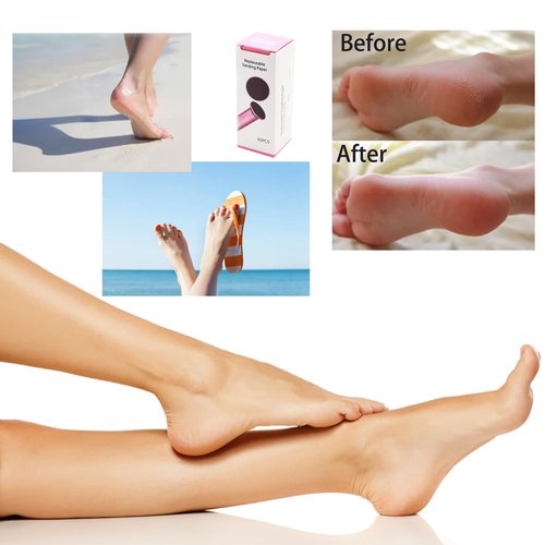 ibubu Electric Feet Callus Remover Silver & 3 Items Replaceable Sandpaper(80/100/180 Grit)
