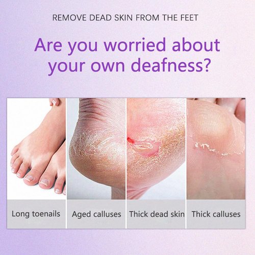 Guxxbix Electric Callus Remover Professional Foot File Adjustable Speed, Adjustable F/R Dual Grind Heads Smooth Skin Foot File (Rose red)